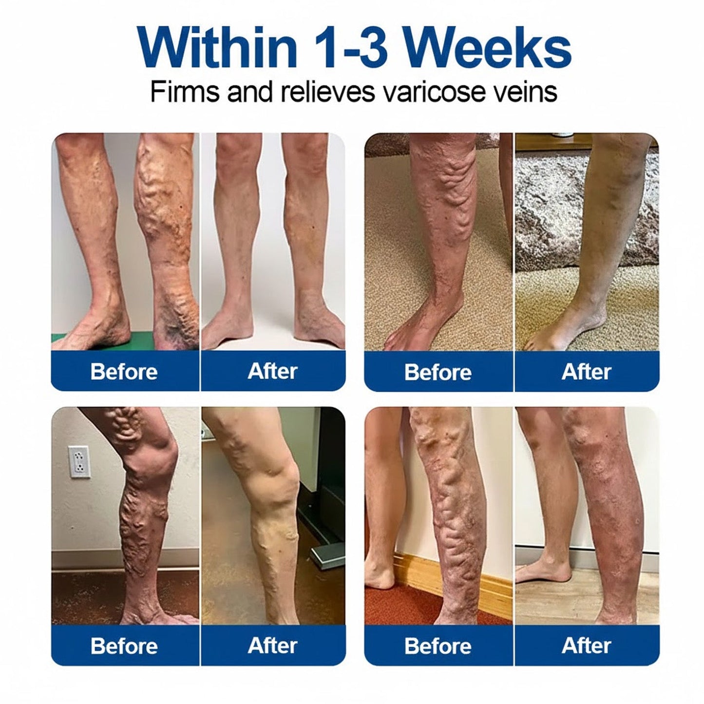 🇺🇸👨‍⚕️✅TAILEDEN® VeinEase Microneedle Care Patch⚡Instant Relief, Long-Term Results