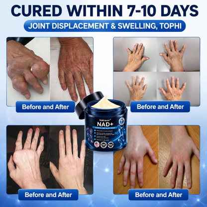🔥🔥Official Store:  🦵𝐍𝐚𝐭𝐫𝐚𝐯𝐨𝐫™ NAD+ Advanced Anti-Aging Joint Relief Cre am (Specially for mature adults & recommended for daily joint care)🔥𝑳𝒂𝒔𝒕 𝒅𝒂𝒚 𝒑𝒓𝒐𝒎𝒐𝒕𝒊𝒐𝒏 7𝟎% 𝒐𝒇𝒇