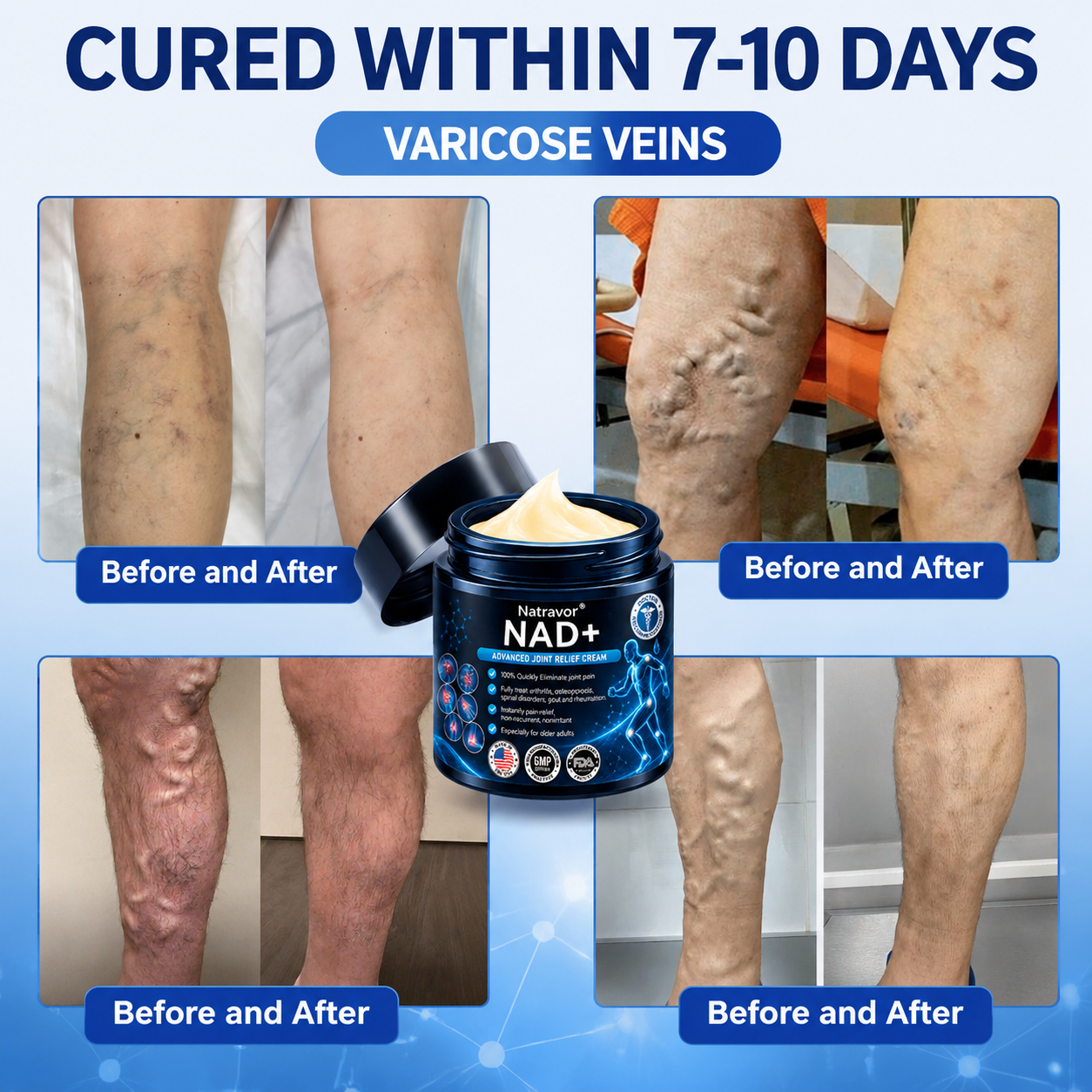🔥🔥Official Store:  🦵𝐍𝐚𝐭𝐫𝐚𝐯𝐨𝐫™ NAD+ Advanced Anti-Aging Joint Relief Cre am (Specially for mature adults & recommended for daily joint care)🔥𝑳𝒂𝒔𝒕 𝒅𝒂𝒚 𝒑𝒓𝒐𝒎𝒐𝒕𝒊𝒐𝒏 7𝟎% 𝒐𝒇𝒇