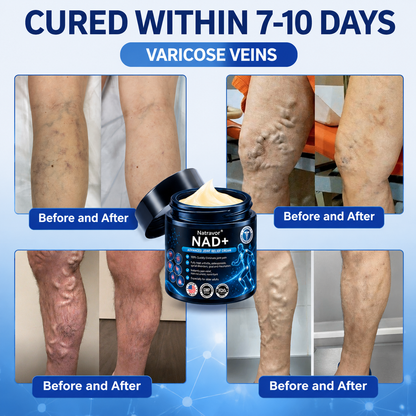 🔥🔥Official Store:  🦵𝐍𝐚𝐭𝐫𝐚𝐯𝐨𝐫™ NAD+ Advanced Anti-Aging Joint Relief Cre am (Specially for mature adults & recommended for daily joint care)🔥𝑳𝒂𝒔𝒕 𝒅𝒂𝒚 𝒑𝒓𝒐𝒎𝒐𝒕𝒊𝒐𝒏 7𝟎% 𝒐𝒇𝒇