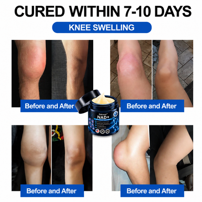 🔥🔥Official Store:  🦵𝐍𝐚𝐭𝐫𝐚𝐯𝐨𝐫™ NAD+ Advanced Anti-Aging Joint Relief Cre am (Specially for mature adults & recommended for daily joint care)🔥𝑳𝒂𝒔𝒕 𝒅𝒂𝒚 𝒑𝒓𝒐𝒎𝒐𝒕𝒊𝒐𝒏 7𝟎% 𝒐𝒇𝒇